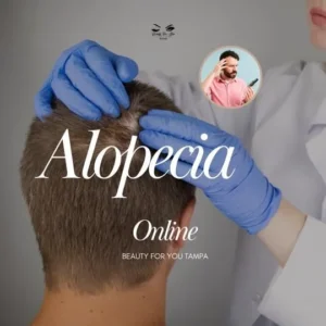 Alopecia