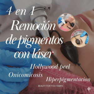 Láser 4 en 1 (Remoción, Hiperpigmentación, Onicomicosis, Hollywood Peel) - Atlanta