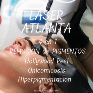 Láser 4 en 1 (Remoción, Hiperpigmentación, Onicomicosis, Hollywood Peel) - Atlanta